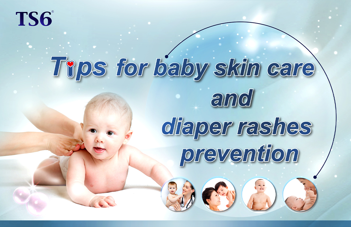 Tips for Baby Skin Care and Preventing Nappy Rash